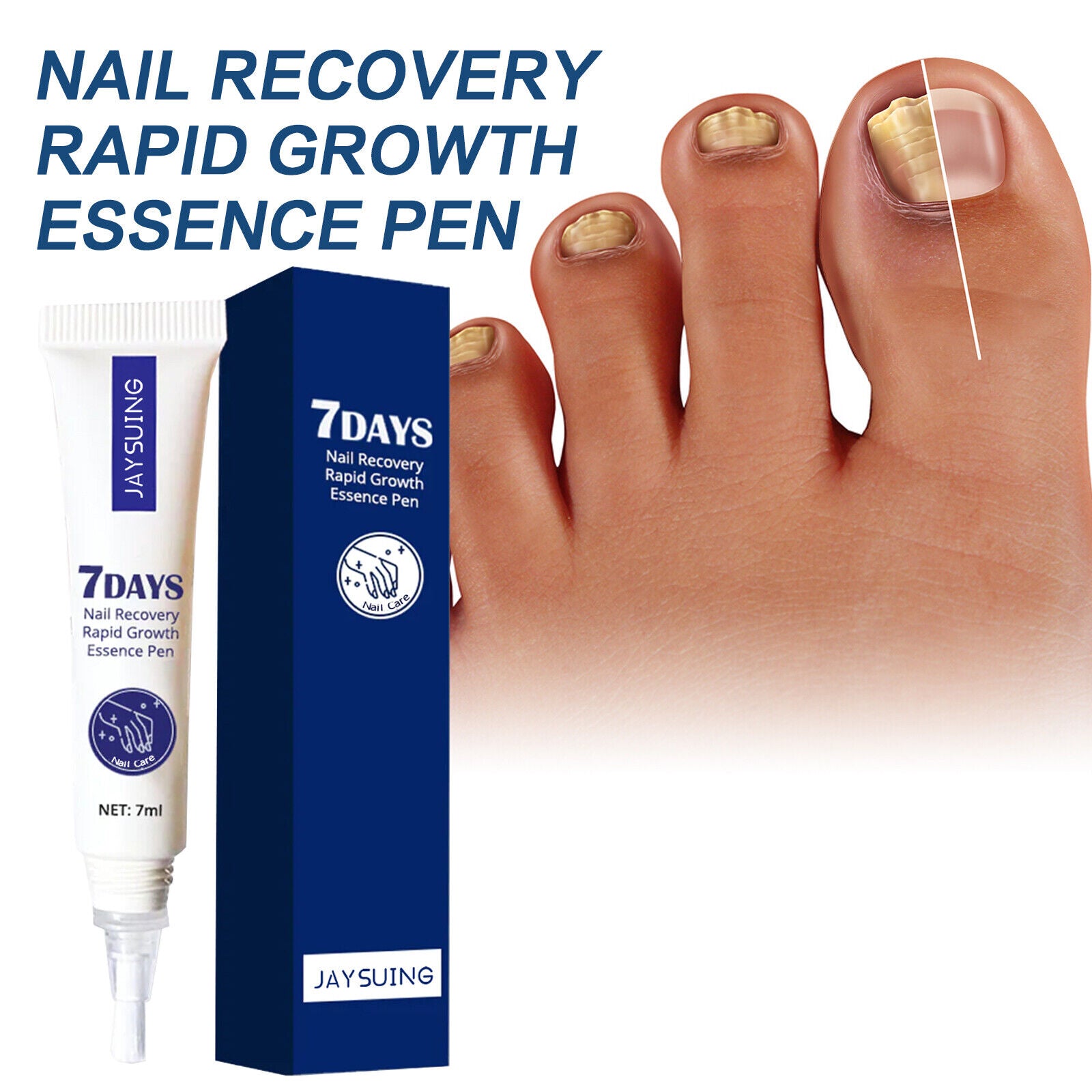 7 Days Nail Recovery Pen – SHIPCALL